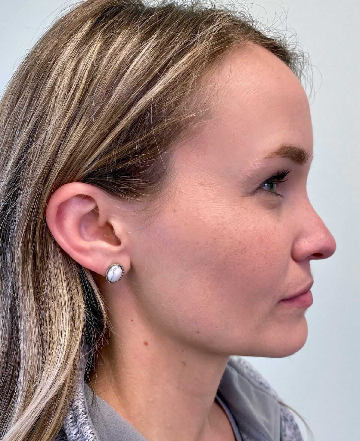 Side View